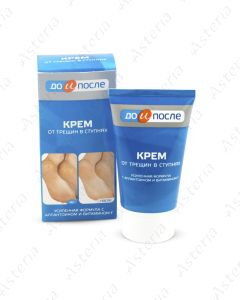 Do I Posle cream against cracks on the legs 150ml